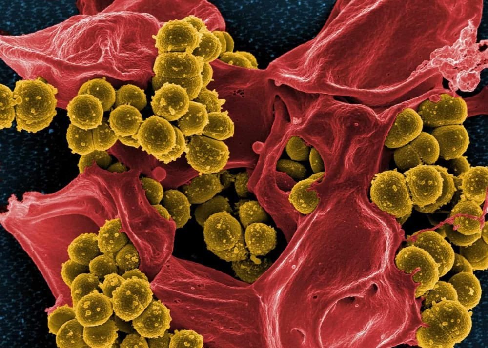 vi khuẩn Staphylococcus aureus gây áp xe vú